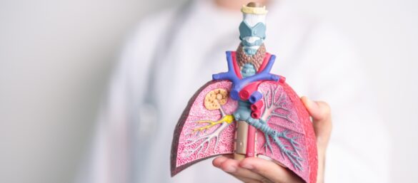 Doctor,With,Smoker,And,Normal,Lung,Anatomy,For,Disease.,Lung Kronik Bronşit